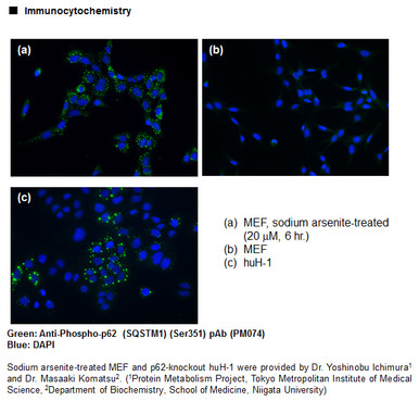 Anti-Phospho-p62 (SQSTM1) (Ser351) pAb