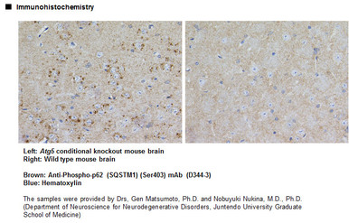 Anti-Phospho-p62 (SQSTM1) (Ser403) mAb (Clone: 4C8)