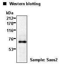 Anti-Runx2 (Cbfa1) mAb (Clone: 8G5)