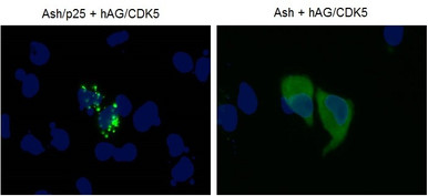 PPIs Detection Reagent : Fluoppi [ CDK5-p25 ]