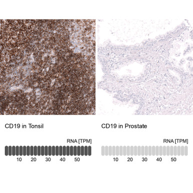 Anti CD19 mAb (Clone No.CL15459, ATL-AMAb92044)