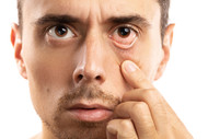 ​Do It Yourself Remedies To Manage Dry Eyes