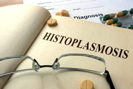 Histoplasmosis: Symptoms, Diagnosis And Treatment