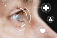 Things to know about Floppy Iris Syndrome