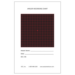 An Amsler grid is a test card that looks a lot like graph paper