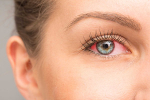 ​Anti VEGF Treatment