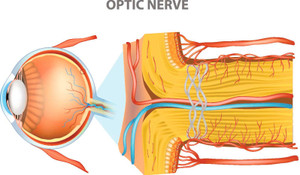 Choroidal Neovascular Membrane
