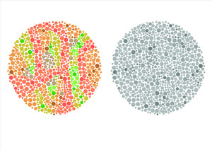 Color Blindness: ​Symptoms And Causes  