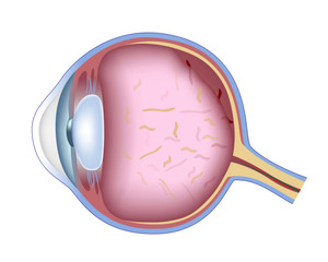 ​Eye Flashes and Floaters