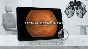 Retinal Detachment in High Myopia: Signs, Risk Factors, and Management Strategies