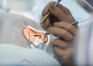 ​Diagnosis and Treatment for Retinal Detachment
