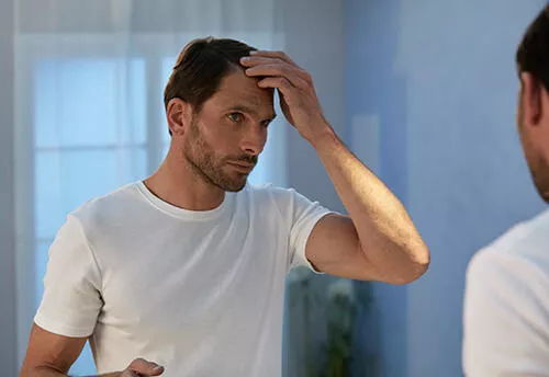 The 5 Main Causes of Hair Loss