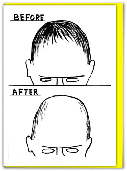 Funny Birthday Card Before After By David Shrigley
