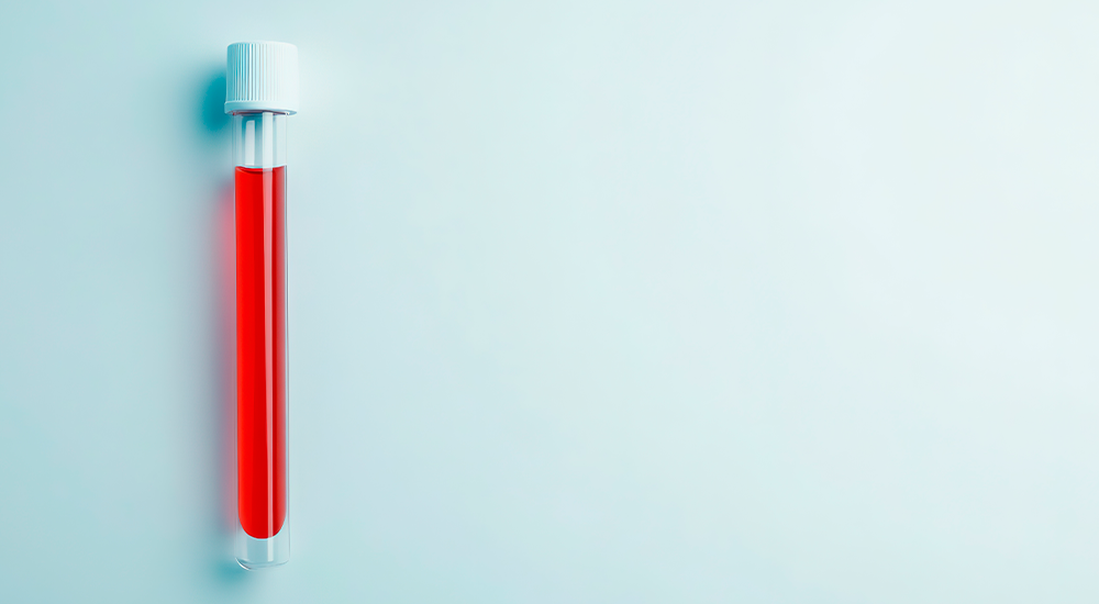 imagen medición de hemoglobina glicosilada