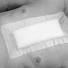 3M 2861 MEDIPORE H SOFT CLOTH SURGICAL TAPE