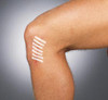 DERMA SCIENCES TS3104 SUTURE STRIP WOUND CLOSURE STRIPS