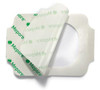 MOLNLYCKE 670900 WOUND MANAGEMENT - MEPORE