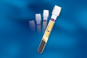 Bd 362788 Vacutainer Ppt Plasma Preparation Tube