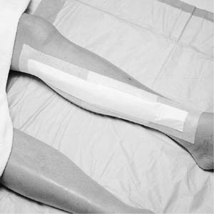 3M 3569 MEDIPORE +PAD SOFT CLOTH ADHESIVE WOUND DRESSING