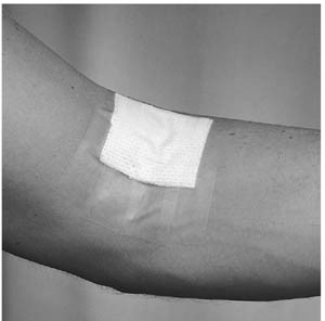 3M 1525-1 BLENDERM SURGICAL TAPE