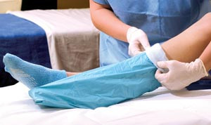 ALBA 20838 STERILE STOCKINETTE