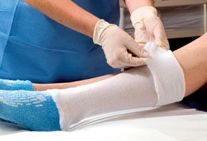 ALBA 81420 NON-STERILE STOCKINETTE
