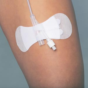 TIDI 3400LFC GRIP-LOK FOLEY SECUREMENT DEVICE