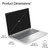 HP DP4Q1AT not categorized