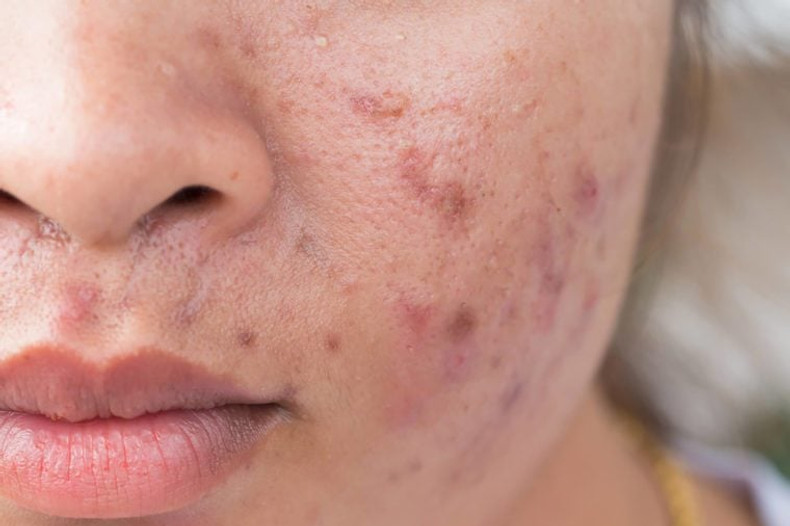 REASONS WHY YOUR SKINCARE ROUTINE ISN'T WORKING AND HOW TO FIX IT