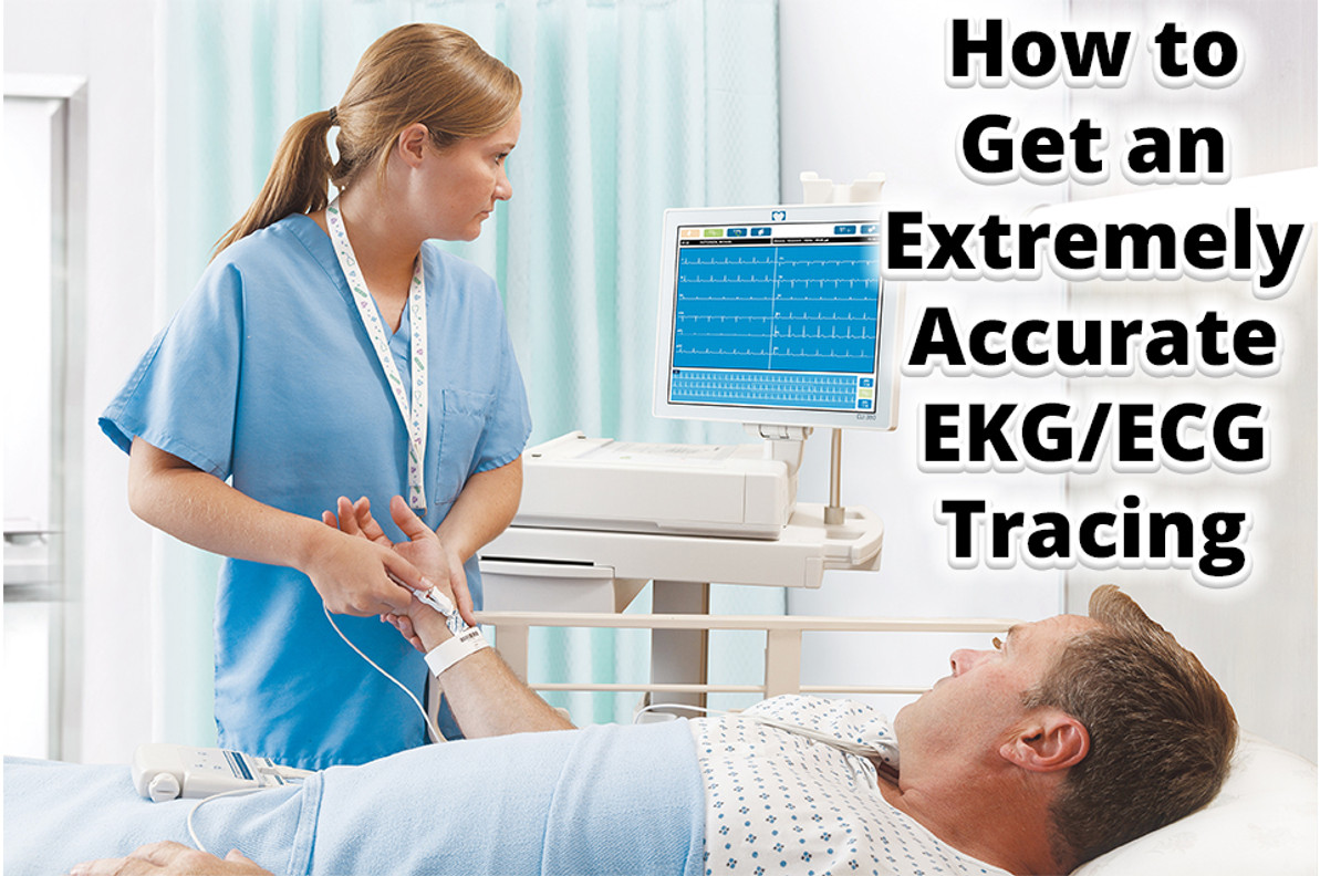 ​How to Get an Extremely Accurate EKG/ECG Tracing
