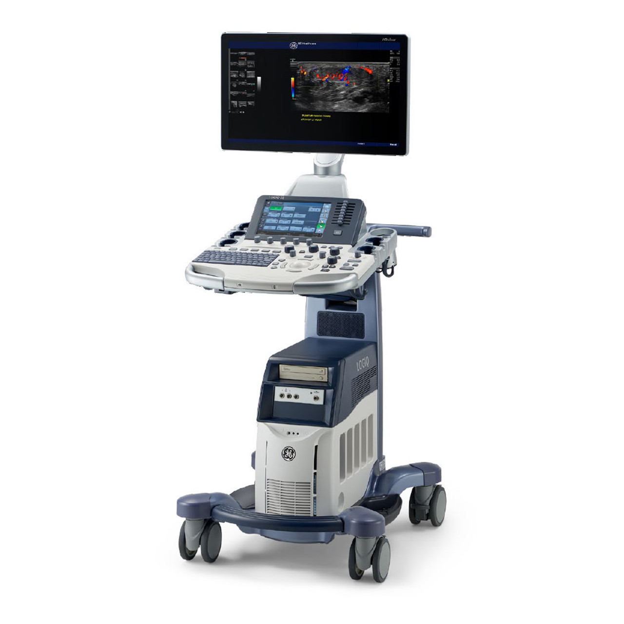 GE LOGIQ E9 XDclear 2.0 Ultrasound System | Jaken Medical