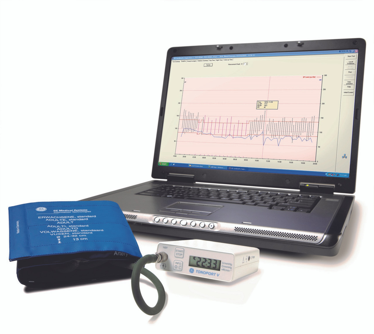 LAB24: Ambulatory Blood Pressure Monitoring - Bionet America