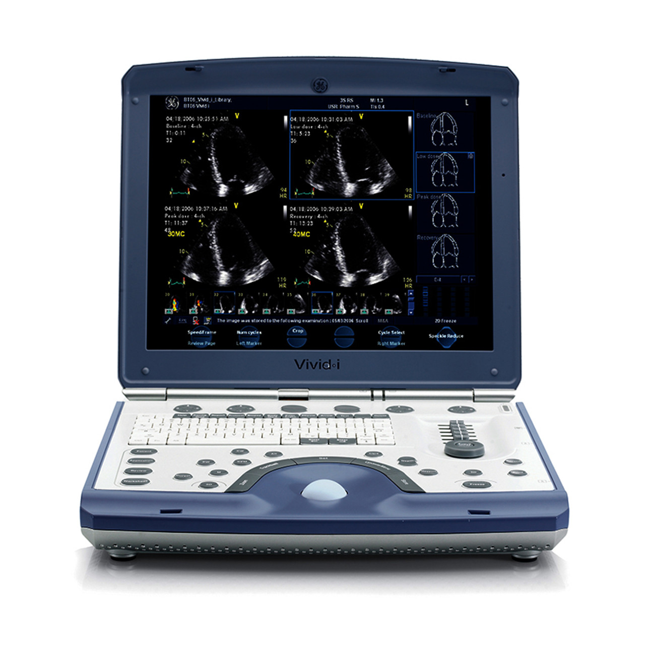 jaken medical ultrasound systems