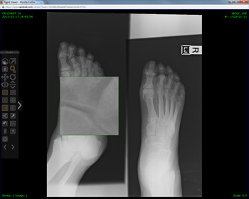 Intella PACS Cloud-Based RIS/PACS Intella PACS Cloud-Based RIS/PACS