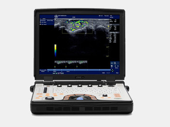 GE NextGen LOGIQ e R7 Ultrasound System  GE NextGen LOGIQ e R7 Ultrasound System