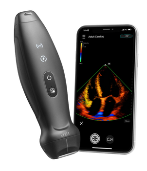 Mindray TE Air: Wireless Handheld Ultrasound Mindray TE Air: Wireless Handheld Ultrasound
