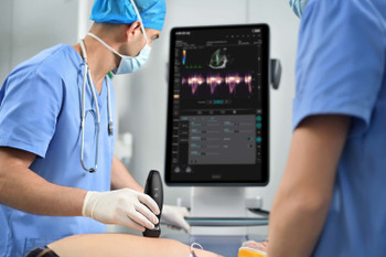 Mindray TE Air: Wireless Handheld Ultrasound Mindray TE Air: Wireless Handheld Ultrasound