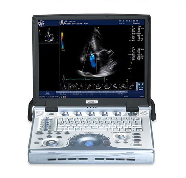 GE Vivid e Compact Ultrasound System Rental