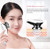 Radio Frequency Beauty Device – Skin Tightening, Wrinkle Reduction & Facial Rejuvenation Tool