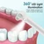 Multifunction Electric Tooth Polisher – 5 Mode Oral Cleaning Device