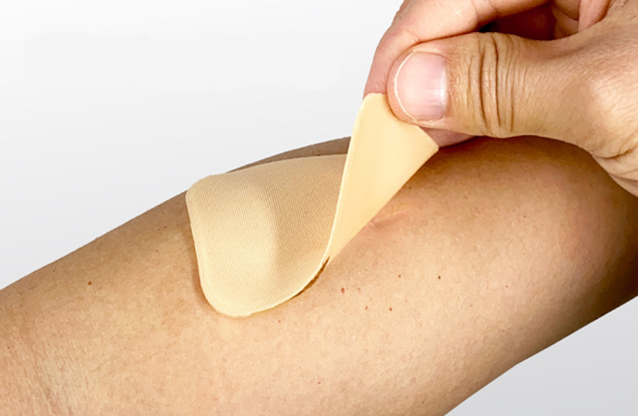 Arm Scar Silicone Sheets, Treatment, healing, removal, management, reduction