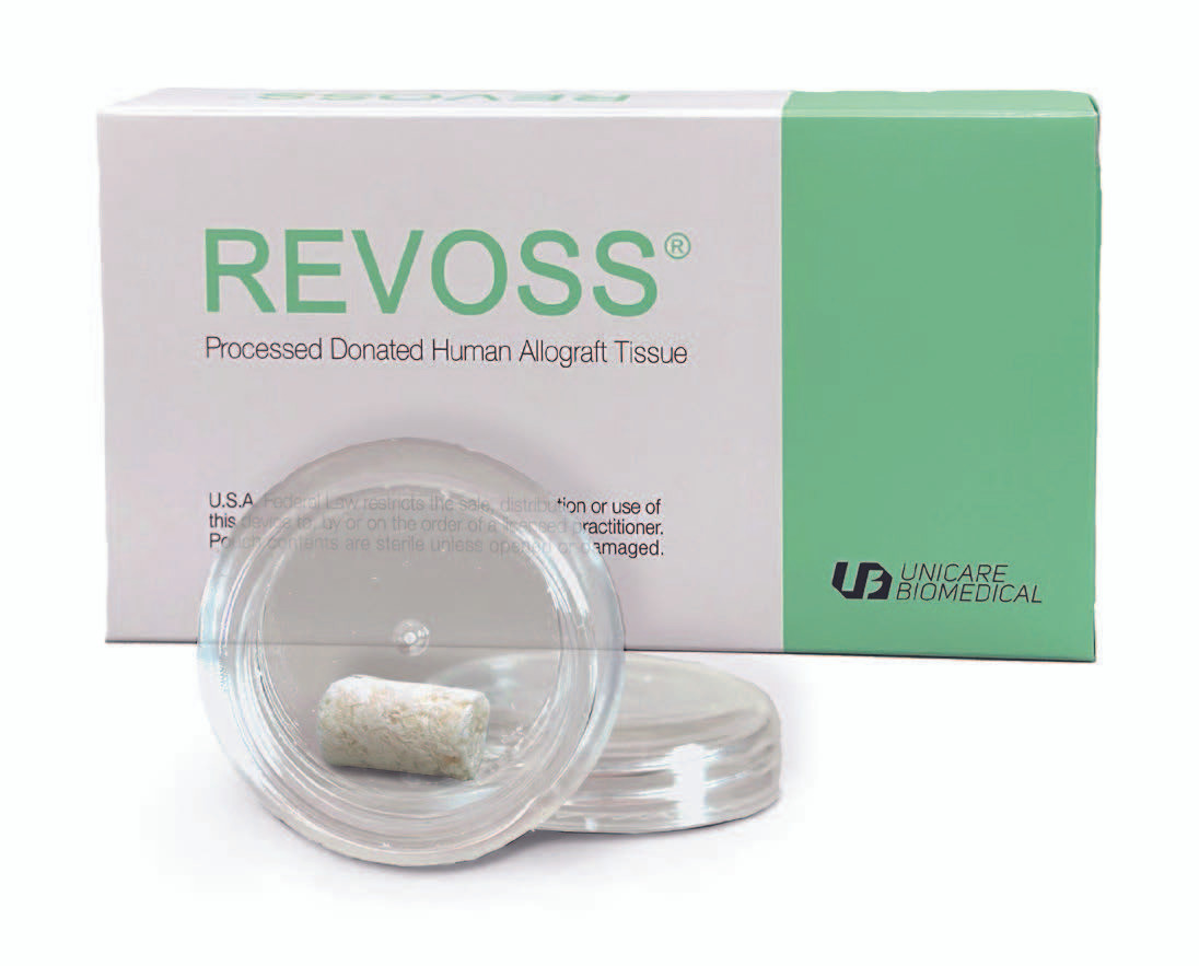 REVOSS Matrix Bone Fiber Plugs | AD Surgical