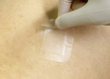 Clearance Hydrogel Wound Dressings