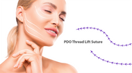 PDO Thread Lift Sutures: Application Method, Indications, and Benefits