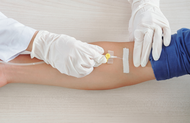 How to Start an IV Using a Peripheral IV Catheter: A Step-by-Step Guide