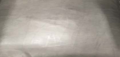 GENUINE WRINKLES, STRETCH MARKS AND CREASES