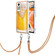 Xiaomi Redmi Note 12 Pro 4G Global Electroplating Dual-side IMD Phone Case with Lanyard - Draft Beer