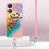 OPPO A78 / A58 Electroplating IMD TPU Phone Case with Lanyard - Dream Butterfly
