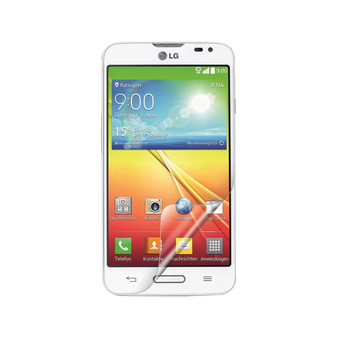 LG L70 Vivid Screen Protector