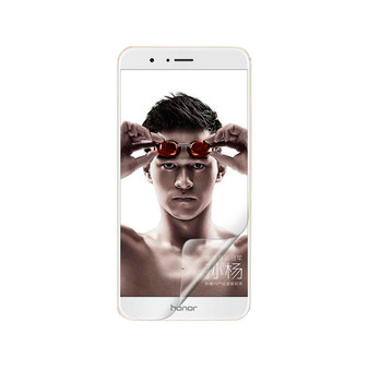 Huawei Honor 8 Pro Vivid Screen Protector